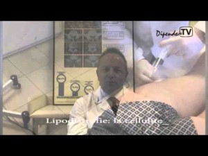 Ossigeno-Ozono terapia: il Dott. Antonio Galoforo espone le applicazioni nel campo dell’estetica